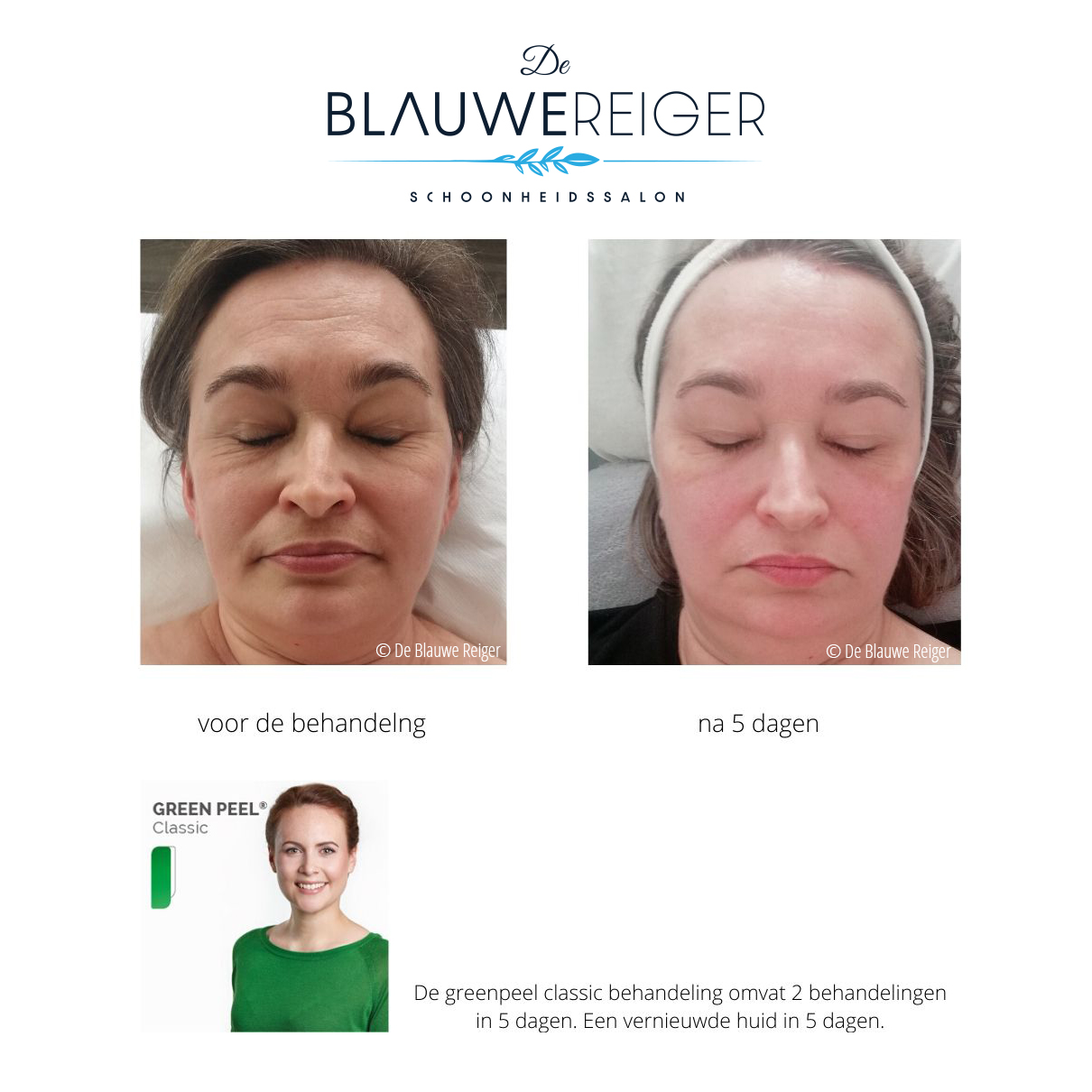 de blauwe reiger greenpeel classic veroudering